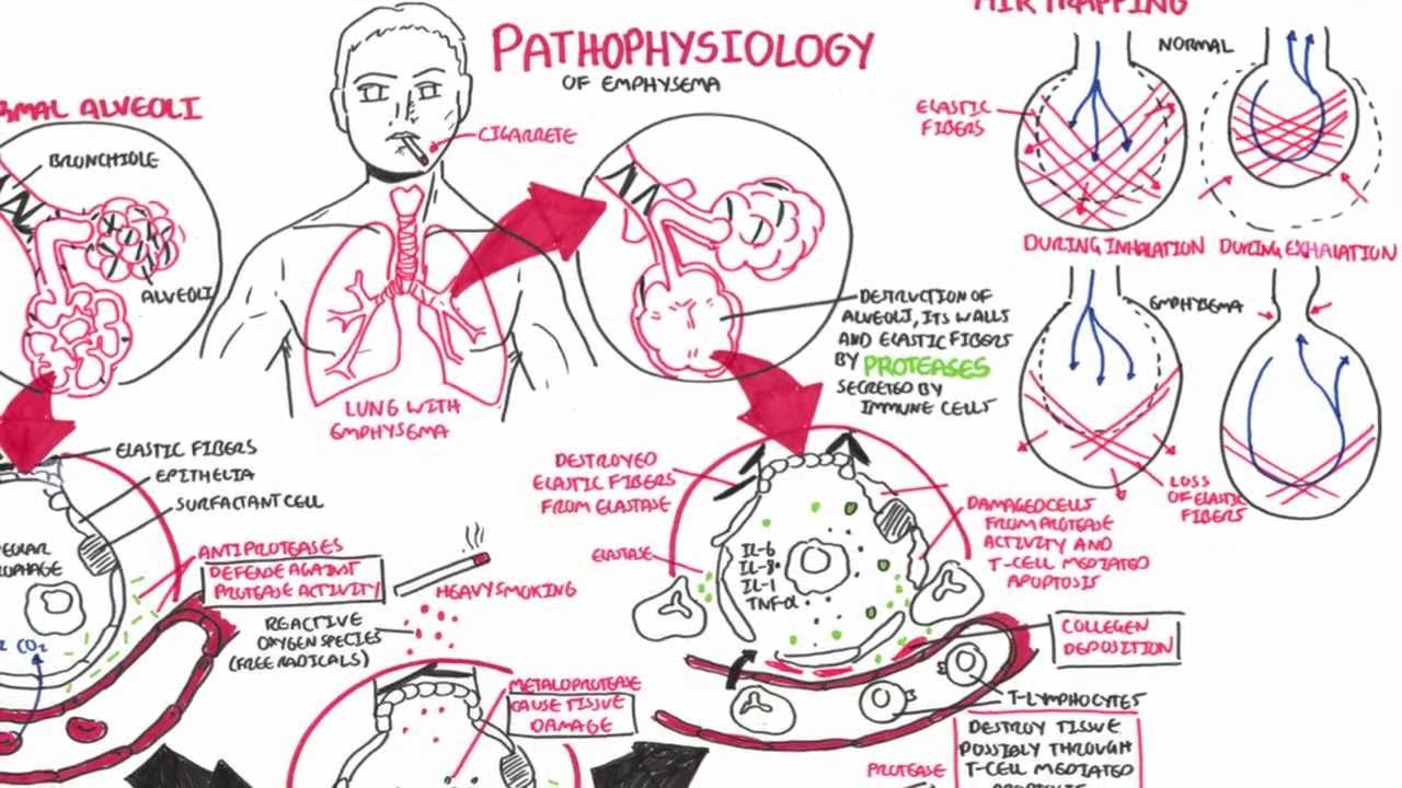 Course Image Medi1154 : Patfizioloģija. Slimību izcelsmes mehānismi 