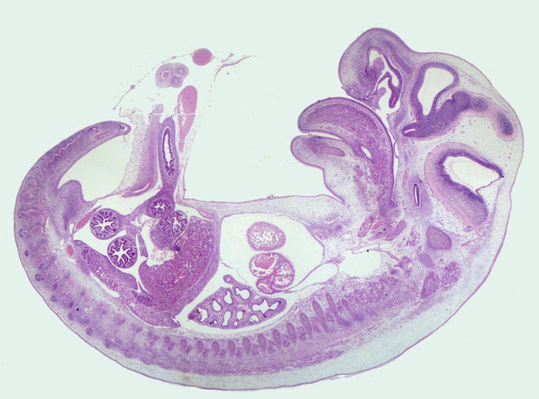 Course Image Medi2059-28401-28408 : Medicīnas Embrioloģija